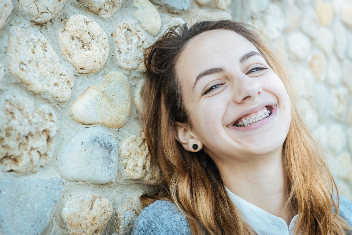 Busting the Top Braces Myths
